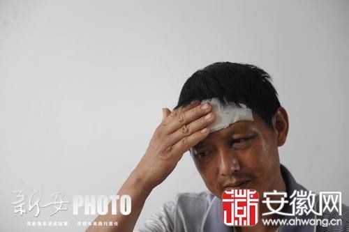 汪师傅回忆起当时一幕，称感到很恐惧，他自己现在头部和身上多处受伤。